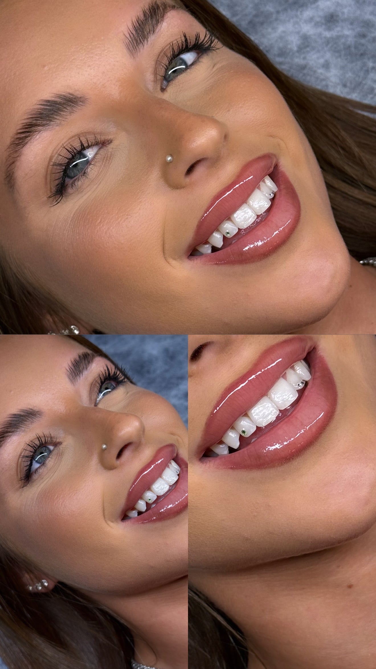 CURSO ONLINE DE GEMAS DENTALES